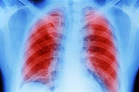 What is the likelihood of mesothelioma after exposure to asbestos?