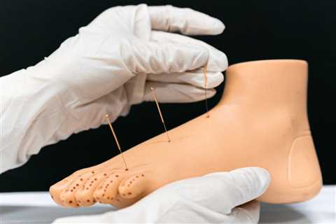 How Long is Training for Acupuncture?