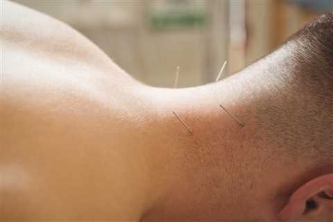 Physical Therapy Acupuncture Training