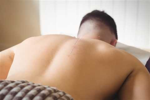 USING ACUPUNCTURE FOR CHRONIC LOWER BACK PAIN MANAGEMENT