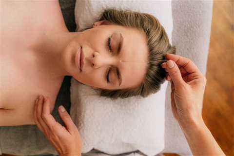 HOW TO USE ACUPUNCTURE FOR INSOMNIA RELIEF