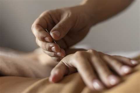 HOW TO USE ACUPUNCTURE FOR SCIATICA PAIN RELIEF